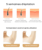 épilateur à lumière pulsée ipl + épilateur haute précision gratuit