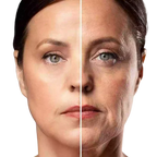 Massageur Fасіаl Anti-Rides Lift-Pro Luzzie™